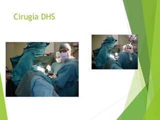 Cirugía DHS
 