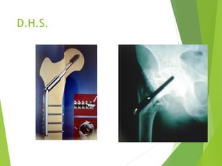 D.H.S.
 