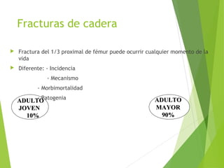 Fracturas de cadera
 Fractura del 1/3 proximal de fémur puede ocurrir cualquier momento de la
vida
 Diferente: - Incidencia
- Mecanismo
- Morbimortalidad
- Patogenia
ADULTOADULTO
JOVENJOVEN
10%10%
ADULTOADULTO
MAYORMAYOR
90%90%
 