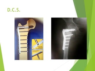 D.C.S.
 
