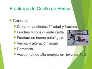 Fracturas de Cuello de Fémur
Causas:
Caída en pacientes 3° edad y fractura .
Fractura y consiguiente caída.
Fractura en hueso patológico.
Vértigo y alteración visual.
Demencia.
Accidentes de alta energía en jóvenes 10%.
 