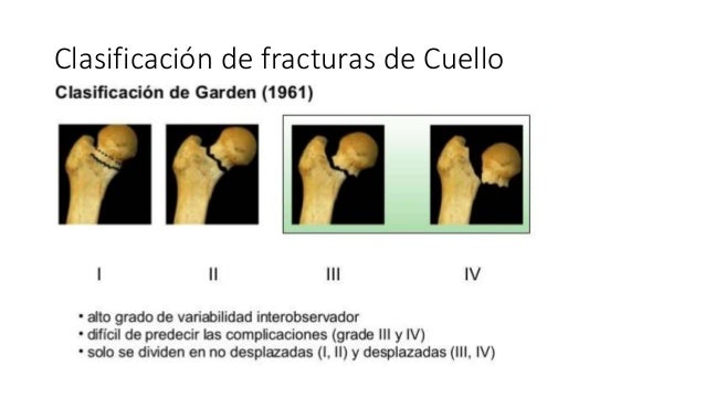 Los ejercicios para embarazado de los dolores en la espalda