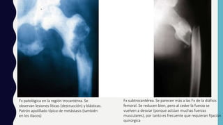 Fx patológica en la región trocantérea. Se
observan lesiones líticas (destrucción) y blásticas.
Patrón apolillado típico de metástasis (también
en los iliacos)
Fx subtrocantérea. Se parecen más a las Fx de la diáfisis
femoral. Se reducen bien, pero al ceder la fuerza se
vuelven a desviar (porque actúan muchas fuerzas
musculares), por tanto es frecuente que requieran fijación
quirúrgica
 
