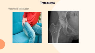 Tratamiento
Tratamiento conservador
 