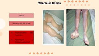 Valoración Clínica
Deformidad del Muslo
Dolor
● Acortamiento del
miembro
● Angulación y
Rotación anormal
 