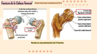 Fractura de la Cabeza Femoral
Recibe su vascularización de 3 Fuentes
Estas fracturas complican el 10 %
 