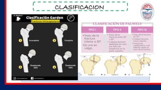 CLASIFICACION
 