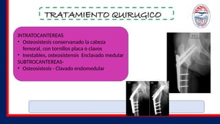 TRATAMIENTO QUIRUGICO
INTRATOCANTEREAS
• Osteosistesis conservanado la cabeza
femoral, con tornillos placa o clavos
• Inestables, osteosistensis Enclavado medular
SUBTROCANTEREAS-
• Osteosistesis - Clavado endomedular
 