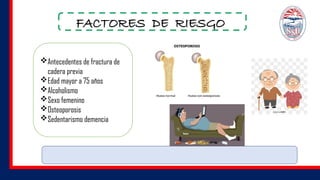 FACTORES DE RIESGO
Antecedentes de fractura de
cadera previa
Edad mayor a 75 años
Alcoholismo
Sexo femenino
Osteoporosis
Sedentarismo demencia
 