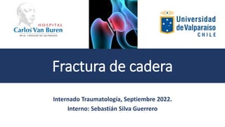 Fractura de cadera
Internado Traumatología, Septiembre 2022.
Interno: Sebastián Silva Guerrero
 