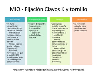 MIO - Fijación Clavos K y tornillo
Indicaciones
•Fractura
intraarticular
desplazada de tipo
depresión articular.
Individuo con
malestar médico
que impide la
reducción total
abierta
Tipo de fractura
simple (solo dos
fragmentos)
Pacientes
mayores en los que
la incisión ORIF
grande puede tener
un alto riesgo de
complicaciones
Contraindicaciones
•Más de 3 días entre
traumatismo e
intervención
quirúrgica.
Depresión
articulada tipo
fractura
Ventajas
•La cirugía de
incisión pequeña
puede promover un
mejor rango de
movimiento en la
rehabilitación
temprana
Menos
posibilidades de
complicación de la
herida
Oportunidad
para la cirugía en
pacientes médicos
marginales
(fumadores
pesados,
diabéticos)
Desventajas
•La reducción
articular no se
puede ver tan
perfectamente
AO Surgery Fundation Joseph Schatzker, Richard Buckley, Andrew Sands
 