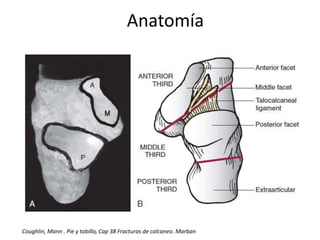 Anatomía
Coughlin, Mann . Pie y tobillo, Cap 38 Fracturas de calcaneo. Marban
 