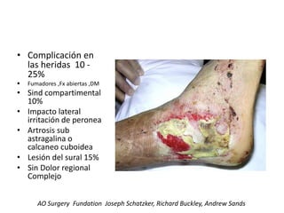 • Complicación en
las heridas 10 -
25%
 Fumadores ,Fx abiertas ,DM
• Sind compartimental
10%
• Impacto lateral
irritación de peronea
• Artrosis sub
astragalina o
calcaneo cuboidea
• Lesión del sural 15%
• Sin Dolor regional
Complejo
AO Surgery Fundation Joseph Schatzker, Richard Buckley, Andrew Sands
 