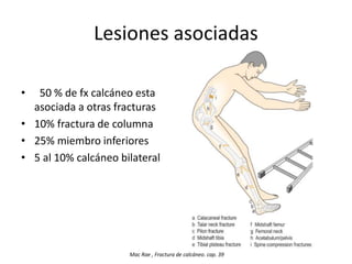 Lesiones asociadas
• 50 % de fx calcáneo esta
asociada a otras fracturas
• 10% fractura de columna
• 25% miembro inferiores
• 5 al 10% calcáneo bilateral
Mac Rae , Fractura de calcáneo. cap. 39
 