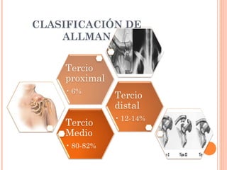 CLASIFICACIÓN DE
    ALLMAN
 