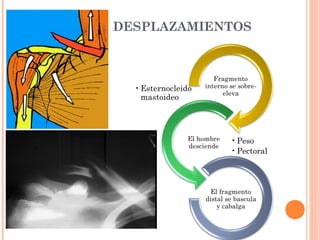 DESPLAZAMIENTOS




            • Peso
            • Pectoral
 
