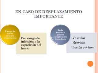 EN CASO DE DESPLAZAMIENTO
       IMPORTANTE
 