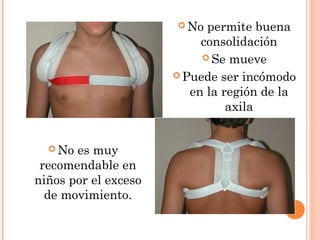  No  permite buena
                           consolidación
                            Se mueve

                       Puede ser incómodo
                         en la región de la
                                axila


   No es muy
 recomendable en
niños por el exceso
  de movimiento.
 