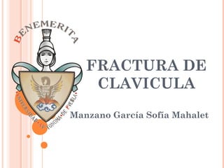 FRACTURA DE
    CLAVICULA
Manzano García Sofía Mahalet
 