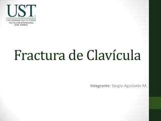 Fractura de Clavícula
Integrante: Sergio Aguilante M.
 