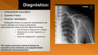 1) Antecedente traumático
2) Examen Físico
3) Examen radiológico:
Radiografia simple en proyección anteroposterior del
hombro afectado que incluya la articulación
esternoclavicular hasta la porción lateral del humero
A) Tipo de fractura / Rasgo único o múltiple.
B) Existencia de un tercer fragmento y su
ubicación.
C) Grado de cabalgamiento o separación.
TAC Usarla unica,ente cuando la fractura se
encuentra en los extremos y se sospecha lesión
intraarticular (fractura/luxación)
 