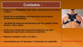  Estado de la circulación distal (pulso, temperatura de los dedos
y mano).
 Estado de la sensibilidad: adormecimiento de los dedos,
sensaciones parestésicas.
 Movilidad de todas las articulaciones que han quedado libres:
hombro, codo y dedos.
 Cuidar que el fragmento proximal de fractura no se haya
desplazado bajo la piel y amenace comprimirla.
 Reponer vendaje en ocho ( 3-5 días ).
 Inmovilización por 4-5 semanas + 2 semanas con cabestrillo. Inmovilizador de clavicula
 