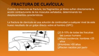 Cuando la clavícula se fractura, los fragmentos ya libres sufren directamente la
acción contracturante de los músculos señalados, determinando los
desplazamientos característicos.
La fractura de clavícula es una solución de continuidad a cualquier nivel de este
hueso resultado de un golpe directo sobre el hombro (GPC)
2.6-10% de todas las fracutras
del cuerpo humano
Mayor incidencia: hombres <25
años
Hombres >55 años
Recien nacidos por parto
 