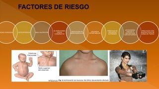 EDAD AVANZADA OSTEOPOROSIS MALA NUTRICIÓN
ALTERACIONES
ÓSEAS
CONGÉNITAS
REDUCCIÓN DE
MASA MUSCULAR
VIOLENCIA
INTRAFAMILIAR
PRÁCTICA DE
DEPORTES
EXTREMOS
ACTIVIDADES
FÍSICAS O
DEPORTIVAS
CON ESFUERZO
PRACTICAS CON
PROYECTILES DE
ARMA DE FUEGO
 