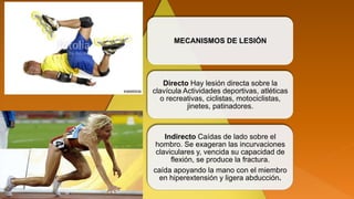 MECANISMOS DE LESIÓN
Directo Hay lesión directa sobre la
clavícula Actividades deportivas, atléticas
o recreativas, ciclistas, motociclistas,
jinetes, patinadores.
Indirecto Caídas de lado sobre el
hombro. Se exageran las incurvaciones
claviculares y, vencida su capacidad de
flexión, se produce la fractura.
caída apoyando la mano con el miembro
en hiperextensión y ligera abducción.
 