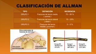 TIPO DEFINICIÓN INCIDENCIA
GRUPO 1 Fracturas de tercio medio
( central )
75 – 85 %
GRUPO 2 Fracturas del tercio lateral
( distal )
15 – 25%
GRUPO 3 Fracturas del tercio
medial ( proximal )
3 – 5 %
 