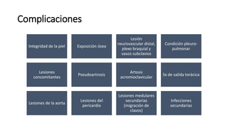 Complicaciones
Integridad de la piel Exposición ósea
Lesión
neurovascular distal,
plexo braquial y
vasos subclavios
Condición pleuro-
pulmonar
Lesiones
concomitantes
Pseudoartrosis
Artosis
acromioclavicular
Sx de salida torácica
Lesiones de la aorta
Lesiones del
pericardio
Lesiones medulares
secundarias
(migración de
clavos)
Infecciones
secundarias
 