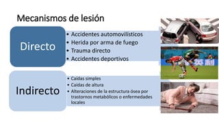 Mecanismos de lesión
• Accidentes automovilísticos
• Herida por arma de fuego
• Trauma directo
• Accidentes deportivos
Directo
• Caídas simples
• Caídas de altura
• Alteraciones de la estructura ósea por
trastornos metabólicos o enfermedades
locales
Indirecto
 
