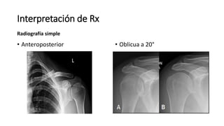 Interpretación de Rx
Radiografía simple
• Anteroposterior • Oblicua a 20°
 