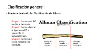 Clasificación general:
• Fractura de clavícula: Clasificación de Allman.
Grupo 1: fractura del 1/3
medio, + frecuente.
Grupo 2: fractura lateral
al ligamento CC, +
frecuente en
pseudoartrosis.
Grupo 3: fractura del
tercio medial de la
clavícula.
 