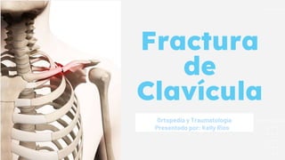 Fractura
de
Clavícula
Ortopedia y Traumatología
Presentado por: Kelly Rios
 