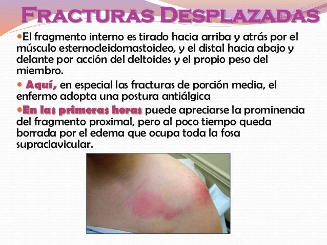 Duele la parte inferior del vientre y los riñones al embarazo de 32 semanas