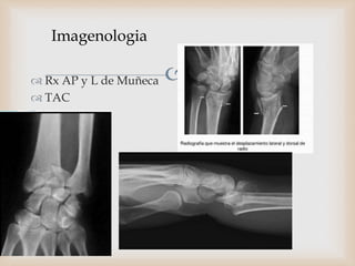 
Imagenologia
 Rx AP y L de Muñeca
 TAC
 