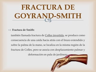 
 Fractura de Smith:
también llamada fractura de Colles invertida, se produce como
consecuencia de una caída hacia atrás con el brazo extendido y
sobre la palma de la mano, se localiza en la misma región de la
fractura de Colles, pero se asocia con desplazamiento palmar y
deformación en pala de jardinero.
FRACTURA DE
GOYRAND-SMITH
 