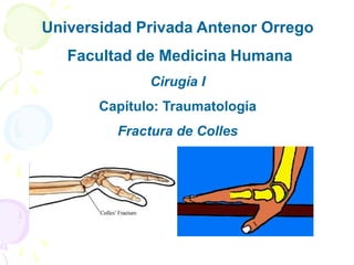 Universidad Privada Antenor Orrego  Facultad de Medicina Humana Cirugía I Capítulo: Traumatología Fractura de Colles 