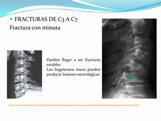  FRACTURAS DE C3 A C7
Fractura con minuta




                                 Pueden llegar a ser fracturas
                                 estables
                                 Los fragmentos óseos pueden
                                 producir lesiones neurológicas




http://www.authorstream.com/Presentation/radiologiamacarena-909422-fracturas-de-la-columna-cervical-carmen-prieto/
 