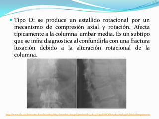 Tipo D: se produce un estallido rotacional por un
       mecanismo de compresión axial y rotación. Afecta
       típicamente a la columna lumbar media. Es un subtipo
       que se infra diagnostica al confundirla con una fractura
       luxación debido a la alteración rotacional de la
       columna.




http://www.tdx.cat/bitstream/handle/10803/8847/Introduccion.pdf;jsessionid=32A04DF391BB6C8B063A25855F337F3B.tdx2?sequence=10
 