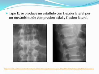  Tipo E: se produce un estallido con flexión lateral por
      un mecanismo de compresión axial y flexión lateral.




http://www.tdx.cat/bitstream/handle/10803/8847/Introduccion.pdf;jsessionid=32A04DF391BB6C8B063A25855F337F3B.tdx2?sequence=10
 