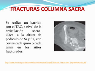FRACTURAS COLUMNA SACRA

Se realiza un barrido
con el TAC, a nivel de la
articulación      sacro-
ilíaca, a la altura de
pedículo de S1 y S2, con
cortes cada 5mm o cada
3mm en los sitios
fracturados.


http://www.sccot.org.co/bancomedios/documentos%20pdf/Fijacion_Percutanea_Septiembre2004.pdf
 