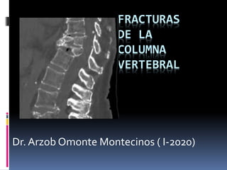 FRACTURAS
DE LA
COLUMNA
VERTEBRAL
Dr. Arzob Omonte Montecinos ( I-2020)
 
