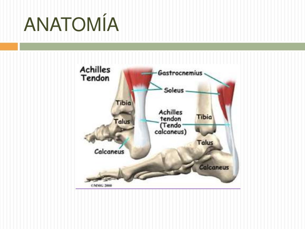 Fractura de cuboides y calcáneo