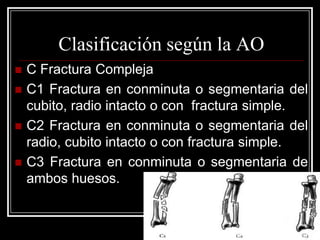 Clasificación según la AO





C Fractura Compleja
C1 Fractura en conminuta o segmentaria del
cubito, radio intacto o con fractura simple.
C2 Fractura en conminuta o segmentaria del
radio, cubito intacto o con fractura simple.
C3 Fractura en conminuta o segmentaria de
ambos huesos.

Algoritmo en el Tratamiento del Trauma Ortopédico - Alcívar

 