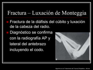 Fractura – Luxación de Monteggia
Fractura de la diáfisis del cúbito y luxación
de la cabeza del radio.
 Diagnóstico se confirma
con la radiografía AP y
lateral del antebrazo
incluyendo el codo.


Algoritmo en el Tratamiento del Trauma Ortopédico - Alcívar

 