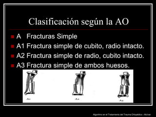 Clasificación según la AO





A Fracturas Simple
A1 Fractura simple de cubito, radio intacto.
A2 Fractura simple de radio, cubito intacto.
A3 Fractura simple de ambos huesos.

Algoritmo en el Tratamiento del Trauma Ortopédico - Alcívar

 