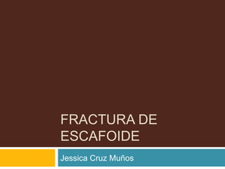 FRACTURA DE ESCAFOIDE  Jessica Cruz Muños  