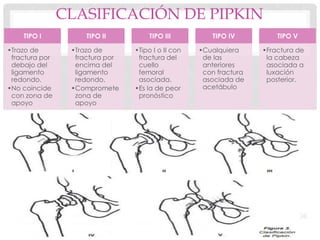 CLASIFICACIÓN DE PIPKIN
TIPO I
•Trazo de
fractura por
debajo del
ligamento
redondo.
•No coincide
con zona de
apoyo
TIPO II
•Trazo de
fractura por
encima del
ligamento
redondo.
•Compromete
zona de
apoyo
TIPO III
•Tipo I o II con
fractura del
cuello
femoral
asociada.
•Es la de peor
pronóstico
TIPO IV
•Cualquiera
de las
anteriores
con fractura
asociada de
acetábulo
TIPO V
•Fractura de
la cabeza
asociada a
luxación
posterior.
 